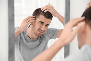 Exemple de calvitie rencontrée par un jeune homme et qui recherche une solution efficace et non visible.